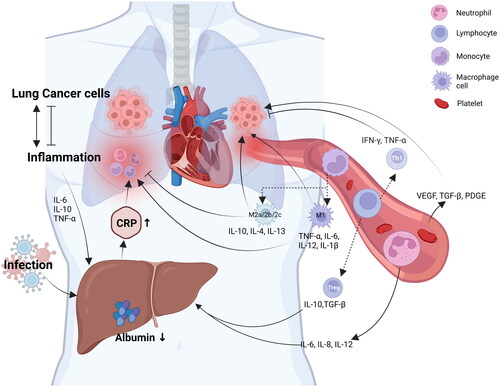 Figure 1. Pro-inflammatory activity of C-reactive protein and peripheral blood cells in non-small cell lung cancer patients with involvement of albumin. Figure created with BioRender.com. IL: interleukin; TNF: tumour necrosis factor; TGF: transforming growth factor; IFN: interferon; VEGF: vascular endothelial growth factor; PDGF: platelet-derived growth factor.