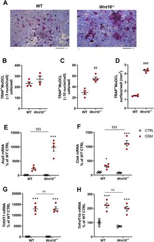 Figure 4 Osteoclastogenesis stimulated by OSM is enhanced in primary calvarial bone cell cultures from Wnt16−/- mice. Primary calvarial periosteal cells from wild-type (WT) and Wnt16−/- mice were stimulated with 100 ng/mL mOSM for 11 days. Cells were TRAP stained (A) and numbers of TRAP+MuOCL with more than 3 (B) and 10 nuclei (C) as well as the total surface (D) covered by TRAP+MuOCL were analyzed. Scale bars, 500 µm. Expression of Acp5 (E), Ctsk (F), Tnfs11 (G) and Tnfrs11b (H) after mOSM treatment for 11 days. Individual values are presented in all graphs with the mean shown as horizontal lines and ±SEM as vertical lines. ###P<0.001, ##P < 0.01 vs WT, Student’s t-test. ***P<0.001*P < 0.05 vs genotype specific untreated control, two-way ANOVA followed by Sidak’s multiple comparison test for the effect of mOSM treatment. §§§P<0.001, ns (not significant) P>0.05 for the effect by mOSM in WT vs the effect by mOSM in Wnt16−/- cells analyzed by interaction in two-way ANOVA.