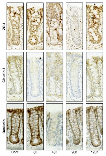 Figure 5. Tight junction protein (ZO-1, claudin-1, and occludin) immunostaining in the colon at selected time points following irinotecan (175 mg/kg ip) administration. Photomicrographs taken at original magnification 400×.