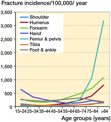 Figure 3. Incidence of fractures per 100, 000 population, according to ISD-10 anatomical distribution.