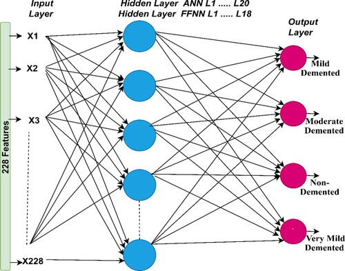 Figure 6. Structure of the ANN and FFNN for classifying the AD data set.