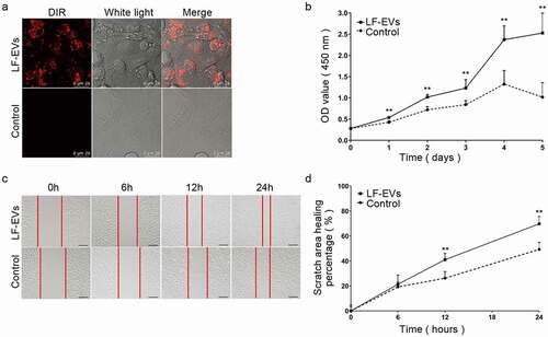 Figure 5. LF-EVs promoted the proliferation and migration of endothelial cells. (a) Representative fluorescence photomicrograph showing the internalization of DiR-labelled-LF-EVs (red) by HUVECs. Scale bar = 25 μm. (b) The proliferation of HUVECs measured using the CCK8 method; the optical density (OD) values from three individual experiments on day 1, 2, 3, 4, and 5 are provided. (c) The images of cell scratch test in HUVECs incubated with LF-EVs (100 μg/mL) or 0.9% normal saline (N.S.) for 6, 12, and 24 h. Bar = 200 μm. (d) The wound-healing percentage of HUVECs is presented as the migration area/original area. Note: (** P < 0.01). LF-EVs, extracellular vesicles derived from lipoaspirate fluid; DiR, DiIC18(7) (1,1ʹ-dioctadecytetramethyl indotricarbocyanine Iodide); HUVECs, human umbilical vein endothelial cells; CCK8, cell counting kit 8