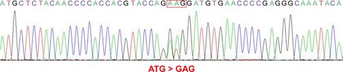 Figure S1 EGFR M277E genetic alterations detected in specimens collected from a NSCLC adenocarcinoma case.Notes: A sequence tracing is given of an EGFR ECD mutation that was identified in NSCLC specimens from a 70-year-old non-smoking female patient. The mutations were somatic alterations of 829A>G and 830T>A, resulting in EGFR M277E-mutant protein products.Abbreviations: ECD, extracellular domain; EGFR, epidermal growth factor receptor; NSCLC, non-small cell lung cancer.