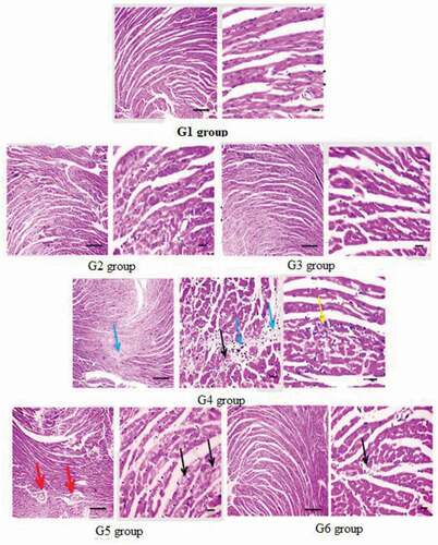 Figure 4. Microscopic photomicrographs of histological sections of cardiac tissue of mice in different groups. G1, G2, and G3 groups showing normal structured cardiomyocytes, G4 group; ME-treated group; showing markedly degenerated cardiomyocytes (black arrows), interstitial edema (blue arrow), few leukocytic cell infiltration (yellow arrow). G5; ME-treated group with 0.75% GTE; showing mild congestion with perivascular edema (red arrows), mildly degenerated cardiomyocytes (black arrows), G6; ME-treated group with 1.5% GTE; showing mild vacuolations in cardiomyocytes (black arrows). X: 400 bar 50