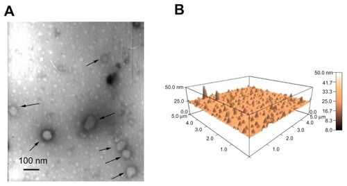 Figure 3 Morphology of lipopolyplexes. Representative images of lipopolyplexes visualized by transmission electron microscopy (A) (black arrows) and atomic force microscopy (B) in the absence of serum.