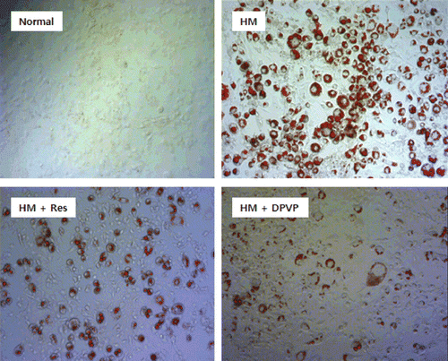 Figure 3.  Photographs of 3T3-L1 adipocytes after Oil Red O staining. HM: hormone mixture (including insulin, dexamethasone, and IBMX), Res: 12.5 µM of resveratrol; DPVP: 12.5 µM of 4-[2-(3,5-dimethoxyphenyl)vinyl]pyridine.