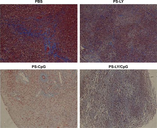 Figure S2 Comparison of Masson’s trichrome staining of tumor tissues under different treatments.Note: Collagen fibers (blue) were rich in the PBS group and poor in other groups.Abbreviations: PBS, phosphate-buffered saline; PS, polyethylenimine-modified carboxyl-styrene/acrylamide; LY, LY215729; CpG, cytosine-phosphate-guanine.