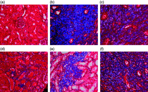 Figure 5. Effect of resveratrol on collagen distribution area in UUO rats. The tissue sections from different groups were stained with Masson staining and observed under light microscope at 400× magnification. Panel a represents sham group; panel b represents model group; panel c represents enalapril group; panel d represents high-dose resveratrol group; panel e represents middle-dose resveratrol group and panel f represents low-dose resveratrol group.