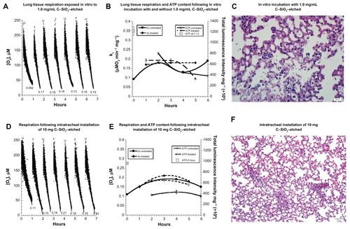 Figure S4 (A–F) Biocompatibility of C–SiO2-etched nanoparticles with lung respiration, adenosine triphosphate (ATP) content, and histology. (A–C) Lung specimens were incubated in vitro at 37°C in oxygenated Krebs–Henseleit (KH) buffer with and without 1.0 mg/dL C–SiO2-etched nanoparticles. Cellular respiration, ATP content, and histology were then measured, as described in Figure 1. Representative O2 runs are shown in (A); rates of respiration (kc, μM O2/minute/mg) are shown at the bottom of each run (U, untreated; T, treated). The values of kc and ATP content are plotted as a function of t in (B). Representative histology (hematoxylin and eosin, 40×) at 4 hours (C) revealed foci of alveolar wall necrosis and apoptotic bodies. (D–F) Lung specimens were collected 60 minutes after intratracheal instillation of 10 mg C–SiO2-etched nanoparticles or 150 μL NaCl. The samples were then incubated in vitro at 37°C in oxygenated KH buffer. Cellular respiration (D and E) and ATP content (E) were measured as a function of time. Representative histology (hematoxylin and eosin, 40×) at 4 hours (F) revealed relatively preserved pulmonary architecture.