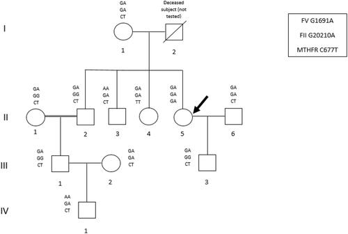 Figure 1 Pedigree of the investigated family with genotypes for the three selected gene variants. The propositus is indicated by an arrow.