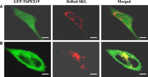 Figure 5.  Intracellular localization of TbPEX19 in mouse fibroblasts. Mouse fibroblasts transfected transiently with plasmids expressing the peroxisomal marker protein DsRed-SKL and GFP-TbPEX19 were examined for direct fluorescence 48 h after transfection. The two extreme observed phenotypes are presented. (A) TbPEX19 is found exclusively in the cytoplasm. (B) TbPEX19 is partially cytoplasmic and partially peroxisomal as shown by its colocalization with DsRed-SKL. Bars, 10 µm.