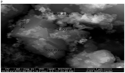 Figure 1. ESEM image of nanocurcumin after coated by platinum (Pt) using a 15 kV beam, magnification 60,000×, working distance 9.2 mm, scale bar 1 μm, particle size of nanocurcumin (34–359.4) nm.