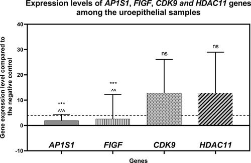 Figure 1. Gene expression levels of the AP1S1, FIGF, CDK9 and HDAC11 genes among the uroepithelial samples studied. The average expression levels of the tested genes are shown. Dashed line marks cut-off value of 4-fold change in gene expression. ***P<0.0001 indicates a statistically significant difference between the AP1S1 and FIGF gene expression levels in comparison to the CDK9 gene. ^^P<0.001 and ^^^P<0.0001 indicate significant difference of AP1S1 and FIGF gene expression levels in comparison to the HDAC11 gene, respectively. "ns" indicates "non-significant" difference between CDK9 and HDAC11 gene expression levels.