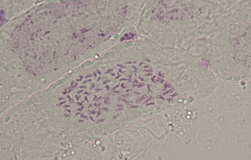 Figure 1. Somatic cell mitotic metaphase chromosomal image of Hibiscus mutabilis f. mutabilis (×400).
