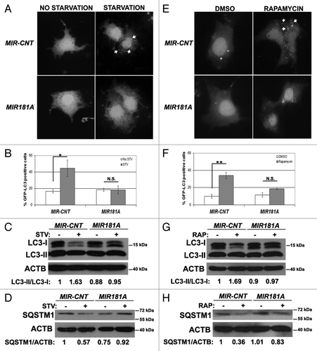 Figure 2. Effect of MI181A on autophagy is not cell-type dependent. (A) MIR181A blocked starvation-induced GFP-LC3 dot formation in Huh-7 cells. Cells were cotransfected with GFP-LC3 plasmid and MIR181A or MIR-CNT and autophagy was assessed under no starvation or starvation (4 h) conditions. (B) Quantitative analysis of the experiments in (A) (mean ± SD of independent experiments, n = 3, *p < 0.05. N.S., not significant). (C) MIR181A expression decreased starvation-induced LC3-I to LC3-II conversion in Huh-7 cells (n = 3). LC3-II/LC3-I ratios are marked. (D) MIR181A blocked starvation-induced SQSTM1 degradation in Huh-7 cells (n = 2). SQSTM1/ACTB ratios are marked. (E) MIR181A blocked rapamycin-induced GFP-LC3 dot formation. Autophagy was assessed following DMSO or rapamycin treatment (2.5 µM, 24 h). (F) Quantitative analysis of the experiments in (E) (mean ± SD of independent experiments, n = 3, **p < 0.01. N.S., not significant). (G) MIR181A resulted in decreased rapamycin-induced conversion of LC3-I to LC3-II in Huh-7 cells (n = 2). RAP, rapamycin. LC3-II/LC3-I ratios are marked. (H) MIR181A blocked rapamycin-induced SQSTM1 degradation in Huh-7 cells (n = 2). SQSTM1/ACTB ratios are marked.