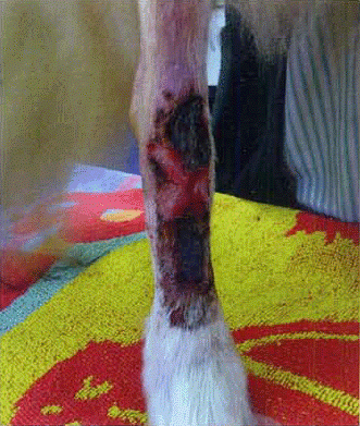 Figure 2. The patient's limb had been ‘casted’. Upon removal of the cast, substantial skin necrosis had occurred