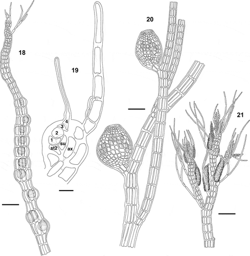 Figs 18–21. Polysiphonia foetidissima: reproductive morphology of Iberian specimens. 18. Branch with tetrasporangia in spiral series. 19. Mature procarp showing the axial cell (ax), the supporting cell (su), one-celled second sterile group (st2) and four-celled carpogonial branch (1–4). 20. Erect axis with cystocarps. 21. Apical portion of an erect axis with cylindrical spermatangial branches. Scale bars = 100 µm (Figs 18, 20, 21), and 10 µm (Fig. 19).
