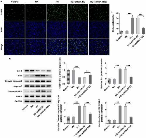 Figure 4. TRB3 interference impedes HG-evoked apoptosis in hRPE cells. (a) TUNEL assay estimated the influence of TRB3 depletion on the apoptosis of HG-stimulated hRPE cells and (b) the quantification. (c) The protein levels of apoptosis-related factors were analyzed by western blot. **P < 0.01, ***P < 0.001. TRB3, Tribbles homolog 3. MA, mannitol. HG, high glucose. Bcl-2, B cell lymphoma-2. Bax, BCL-2 associated X.