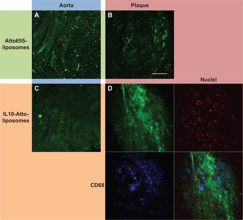 Figure 4 The staining signal of IL10-coated, Atto655 labeled stealth-liposomes, detected on atherosclerotic-plaques and compared to controls.Notes: Atto655 was purchased from ATTO-TEC GmbH, Siegen, Germany. Aortic sections of ApoE-deficient mice were incubated with Atto655-liposomes as a control (A) and (B), or coated with IL10 (C) and (D); NP signals are shown in green. Less-injured aortic areas are shown in (A) and (C) (blue area) and atherosclerotic-plaques in (B) and (D) (red area). The image of the IL10-Atto655-liposome stained plaque is depicted with co-stainings for CD68 (macrophages) shown in blue and for the nuclei shown in red. Atto655-liposomes were found to stain the whole aortic sections unspecifically, while IL10-Atto655-liposomes are preferentially accumulated at atherosclerotic-plaque areas. Bar indicates 50 μm.Abbreviations: IL10, interleukin 10; NP, nanoparticle; ApoE, apolipoprotein E.