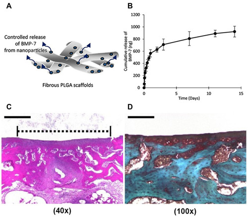 Figure 4 BMP-7 loaded PLGA nanoparticles incorporated with the fibrous PLGA scaffolds for cartilage repair. (A) Schematic illustration demonstrated release BMP-7 from nanoparticles on the PLGA scaffolds. (B) The release kinetic of BMP-7 was measured over 2 weeks. (C) H&E staining demonstrated that PLGA/MSC/BMP-7 group resulted in a thick hyaline cartilage restoration. (D) Safranin-O staining supported PLGA/MSC/BMP-7 group with an obvious GAG deposition. Scale bar: 500 µm.Notes: Reprinted from Kim HJ, Han MA, Shin JY, et al. Intra-articular delivery of synovium-resident mesenchymal stem cells via BMP-7-loaded fibrous PLGA scaffolds for cartilage repair. J Control Release. 2019;302:169–180. Copyright (2019), with permission from Elsevier.Citation106