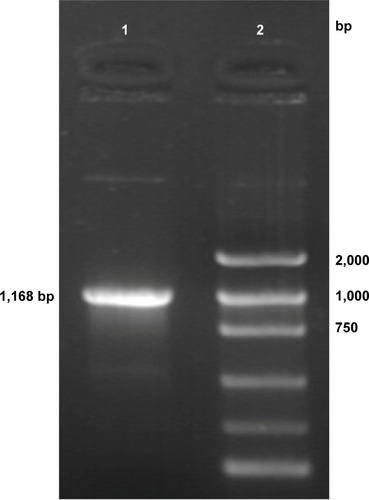 Figure 1 PCR amplification of HSV-TK gene from the pHSV-106 plasmid.Notes: Lane 1, HSV-TK gene PCR amplification products; lane 2, marker (each band in turn from bottom to top is 100, 300, 500, 750, 1,000, and 2,000 bp).Abbreviations: bp, base pair; HSV-TK, herpes simplex virus thymidine kinase; PCR, polymerase chain reaction.