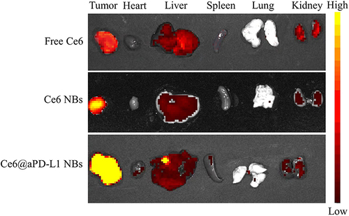 Figure 5 Biodistribution of Ce6 in vivo. After injecting drugs into the PCa-bearing mice for 12 hours, the tumors and major organs were detected with different intensity signal.