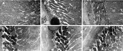 Figure 4 TEM scanning for ultrastructure changes of outer and inner segment of photoreceptors in retinas at 2 weeks after intravitreal injection.Notes: (A) Low group: intravitreal injection of 2.5 mg/0.1 mL PLGA/PLA microspheres; (B) medium group: intravitreal injection of 5 mg/0.1 mL PLGA/PLA microspheres; (C) high group: intravitreal injection of 10 mg/0.1 mL PLGA/PLA microspheres; (D) EPO group: intravitreal injection of 5 mg/0.1 mL EPO–dextran PLGA/PLA microspheres; (E) PBS group: intravitreal injection of 0.1 mL 0.01 M PBS; (F) normal group: normal retinas received no intravitreal injection. No significant morphologic changes were detected in the outer segment disc and inner segment of mitochondria in the groups.Abbreviations: EPO, erythropoietin; IS, photoreceptor inner segment; OS, photoreceptor outer segment; PBS, phosphate-buffered saline; PLGA/PLA, poly(lactic-co-glycolic acid)/poly(lactic-acid); TEM, transmission electron microscope.
