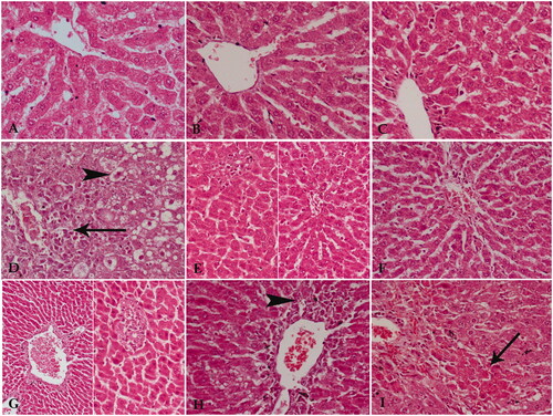 Figure 5. A photomicrograph of liver tissue sections from A) Liver of the negative control rats showed the normal structure of this tissue. B) Livers of positive control of silymarin showed normal structure but with slightly dilated blood sinusoids. C) Livers of positive control of Tagetes lucida root extract showed quite normal architecture of liver tissue. D) Livers of therapeutic control showed a significant distortion of the general architecture of the tissue, necrotic cells around the central veins (arrow), and vacuolar degeneration of many cells at the periphery of the lobules (arrowhead). E) Livers of silymarin-treated therapeutic rats showed a marked amelioration of liver tissue except for small focal areas of necrotic cells and/or dilated blood sinusoids. F) Livers of Tagetes lucida root extract-treated therapeutic rats showed liver tissue close to normal but with few inflammatory cells around central veins. G) Livers of the protective control rats showed dilatation and congestion of main blood vessels with fibrosis. The parenchyma of liver tissue shows a focal aggregation of necrotic cells. H) Livers of silymarin-treated protective rats showed inflammatory and necrotic cells around dilated central veins (arrowhead). I) Livers of Tagetes lucida root extract-treated protective rats showed mild protective effect as areas of acidophilic degenerated cells were observed (arrowhead). Hx & E × 400.
