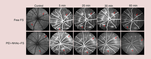 Figure 8. Laser-induced choroidal neovascularization in Brown Norway rats for 28 days, and fundus angiography images at autofluorescence mode and different time points postintravenous injection of free fluorescein sodium or PEI–NHAc–FS nanoparticles at 1% fluorescein sodium concentration.FS: Fluorescein sodium; PEI: Polyethyleneimine.