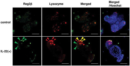 Figure 3. Immunohistochemical detection of Reg3β and lysozyme in enteroids after IL-22 stimulation.Representative confocal images of immunohistochemistry (Reg3β, green; lysozyme, red; nucleus, blue) for enteroids treated in the absence of IL-22 (control) and the presence of 10 ng/mL IL-22 [IL-22 (+)] for 24 h. Green and red arrowheads indicate Reg3β-producing cells and Paneth cells, respectively. Yellow arrowheads indicate the overlapping of Reg3β-producing and Paneth cells. Scale bar is 50 μm.