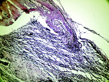 Figure 4. Seventh day empty defect in Group II.