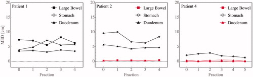 Figure 3. Targets that are in contact with OARs on reference imaging tend to remain in contact, accounting for the consistent OAR violations for almost all fractions. Shown are the minimum Euclidean distance (MED) between the GTV and three luminal OARs (large bowel, stomach, and duodenum) at each fraction for three example patients (1, 2, and 4, respectively). Red indicates organs that are dose-limiting.