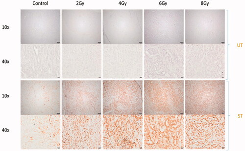 Figure 3. Different RT doses lead to complete tumor RT and induce DNA double strand breaks in KP tumors. KP tumors were treated with a single dose of 2, 4, 6, and 8 Gy and the tumors were harvested 1 h after RT. Sections were stained for γH2AX foci. Control: Mock treated, UT: Untreated, one-step polymer HRP, ST: Stained, γH2AX + one-step polymer HRP; 10x scale bar is 100 µm, 40× scale bar is 20 µm.