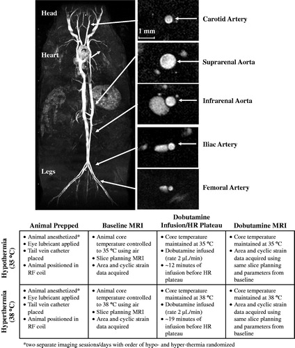 Figure 1. Coronal maximum intensity projection [Citation19] (left) and cross-sectional view of the arteries [Citation21] (right) illustrating arterial locations where imaging data were acquired and quantified. Schematic of protocol timeline (bottom).