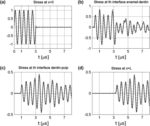 Figure 5 Stress waveforms at: (a) enamel face; (b) enamel/dentin interface; (c) dentin/pulp interface; (d) pulp end. (Grey line: FEM. Black line: equivalent model.)