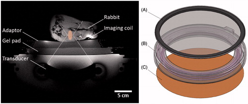 Figure 2. Experimental set-up for mild hyperthermia in rabbit Vx2 tumours using a clinical MR-HIFU system. Left: Axial survey image of a rabbit on top of a water-filled animal adaptor. A waterproofed receive-only imaging coil fits around the lower leg. The bottom film of the animal adaptor is coupled to the window of the clinical HIFU system by a gel pad; the HIFU transducer is in the oil bath below. Overlays indicate the relative size of the ultrasound beam path (dashed) and treatment cell (shaded). Right: Rendering of the animal adaptor designed for the clinical HIFU system. The detachable lid (A) is a polyimide film glued to an acrylic ring. The cylindrical water bath (B) is a 3D-printed shell that holds a volume of degassed water, which is heated by water pumped through a coiled channel printed into the walls of the cylinder. Polyimide film (C) forms the base.