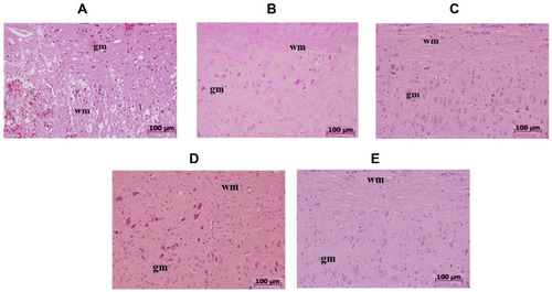 Figure 1 Effect of PHP and ZFL on histological changes on the spinal cord tissue after 24 h inducing spinal injury.