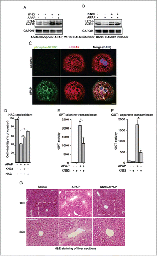 Figure 7. Acetaminophen (APAP) activates the ROS-TRPM2-CAMK2 signaling cascade and thus inhibits autophagy and induces cell death in primary mouse hepatocytes. (A) and (B) APAP (15 mM) decreased LC3-II levels, and this effect of APAP was abolished by pretreatment with W-13 (10 μM) (A) or KN-93 (10 μM) (B) in mouse hepatocytes. (C) APAP (15 mM) treatment markedly induced the phosphorylation of Ser295 on BECN1 in hepatocytes, showing the colocalization with PIK3C3. Scale bar: 10 μm. (D) KN-93 (10 μM) or NAC (15 mM) markedly reversed the toxicity of APAP (15 mM) on hepatocytes. (E) and (F) KN-93 (4 mg/kg) treatment significantly inhibited APAP (500 mg/kg)-induced serum GPT (E) and GOT (F) levels in mouse. (G) KN-93 (4 mg/kg) treatment markedly alleviated APAP (500 mg/kg)-induced liver damage as shown by H&E staining of liver sections 24 h after drug treatment. Scale bar: 100 μm.