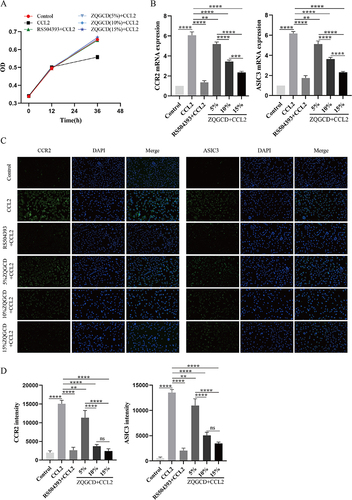 Figure 4 CCL2 induces the expression of CCR2 and ASIC3 in DRGn, which is inhibited by CCR2 inhibitors and ZQGCD containing serum (A) The cell viability of DRGn. After 12 h pretreatment with RS504393 and ZQGCD containing serum (5%, 10%, and 15%), there was no change in cell viability (P>0.05). After adding CCL2 for 24 h, the viability of unpretreated cells decreased significantly (P<0.05), while that of pretreated DRGn did not change compared with the control group (P>0.05). (B) Expression of CCR2 and ASIC3 mRNA in DRGn. (C and D) Expression of CCR2 and ASIC3 proteins in DRGn. **P<0.01, ***P<0.001, ****P<0.0001, ns: P>0.05.