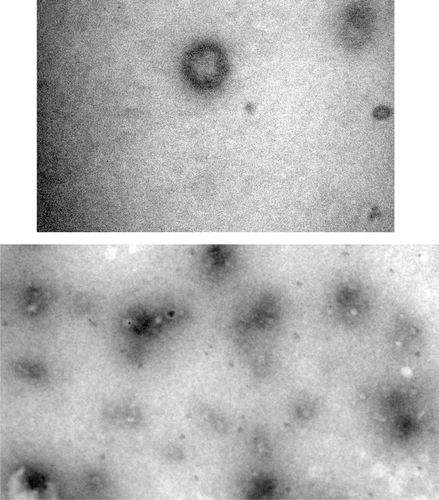 Figure 1. Micrographic images of ICV-1(× 104).