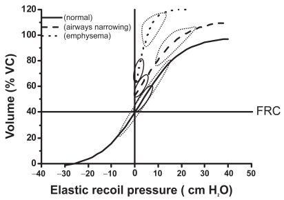 Figure 1 Pressure volume relationship of the passive respiratory system. Lower and upper boundaries of the elastic recoil pressure–volume relationship of the respiratory system in healthy subjects (---), in patients with narrowed airways (—), and in patients with loss of lung elastic recoil (·····). The loops represent tidal breathing at rest (—) and during exercise (·····).