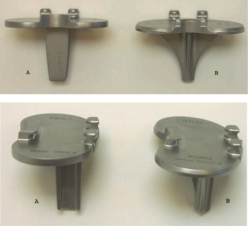 Figure 1. The Maxim I-beam stem (A) and cruxiate (finned) stem (B) tibia stem components used (Biomet).