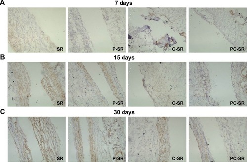 Figure 7 Positive expression degree of α-SMA as analyzed by immunohistochemistry after implantation of silicone rubber materials. (×200)Notes: (A) 7 days. (B) 15 days. (C) 30 days.Abbreviations: SR, silicone rubber; P-SR, patterned silicone rubber; C-SR, C-ion-implanted silicone rubber; PC-SR, patterned C-ion-implanted silicone rubber.