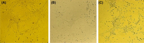 Figure 4. Cell culture on the nanofibrous mats, and the control. (A) The control (TCPS), (B) The un-modified nanofibrous PHBV mat, (C) The chitosan-crosslinked nanofibrous mat.