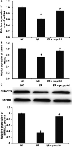 Figure 2. Effect of propofol on the expression of SUMO2/3 in HUVECs with I/R. (A,B) Expression of SUMO2 (A) and SUMO3 (B) mRNA in HUVECs without I/R (NC group), HUVECs with I/R (I/R group) and HUVECs with I/R that were treated with propofol. qRT-PCR was used to determine mRNA expression. *p < 0.05 compared with NC group; #p < 0.05 compared with I/R group. (B) Expression of SUMO2/3 proteins in HUVECs of NC group, I/R group and I/R + propofol group. Western blotting was used to determine protein expression. *p < 0.05 compared with NC group; #p < 0.05 compared with I/R group.