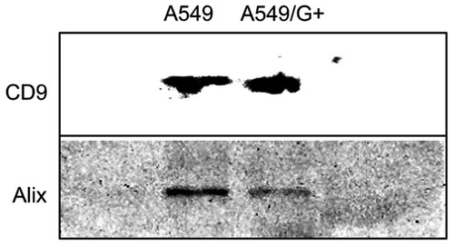 Figure 4 The Western blotting of exosomes.