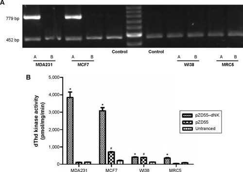 Figure 2 Detection of the Dm-dNK gene expression and examination of the enzymatic activity.