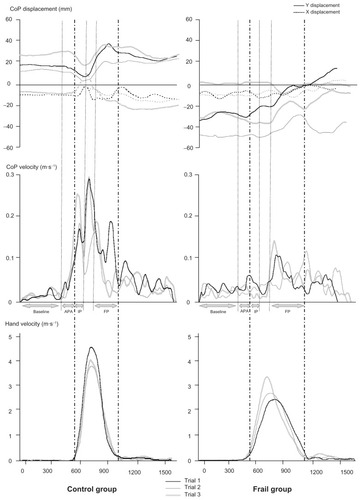 Figure 2 Typical data for two representative subjects (left, control group; and right, frail group) for three trials in the choice reaction time condition. Upper panel: CoP displacement in the medio-lateral axis (X) and antero-posterior axis (Y). Middle panel: CoP velocity profiles. Lower panel: hand velocity profiles. Horizontal axis represents time; acquisition duration is divided into four phases: baseline (−600 ms to −150 ms); APA phase (−150 ms to t0); IP (t0 to 100 ms); and FP (between the hand deceleration beginning to the hand movement offset).