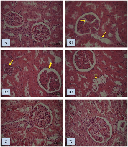 Figure 3. Histological kidney sections of (A) control and (B1, B2 and B3) treated rats with penconazole, (C) N. retusa aqueous extract along with penconazole and (D) N. retusa aqueous extract. Optic microscopy: H&E (400×). Arrows indicate: Glomeruli fragmentation, necrosis of the epithelial cells lining the tubules, Bowman’s space enlargement, inflammatory leucocytes infiltration