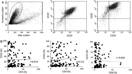 Figure 1. CD25 expression in DLBCL. DLBCL cells are identified by forward and side scatter properties, and CD25 expression on the cells is shown using two-color flow cytometry (A). There is no relationship between CD25-positivity and one of CD3, CD4, and CD8-positivity (B) in the gated regions. r, correlation coefficient.